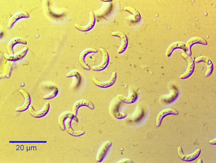 トキソプラズマとマラリア原虫:「膜リサイクル」の決定的違いが判明
